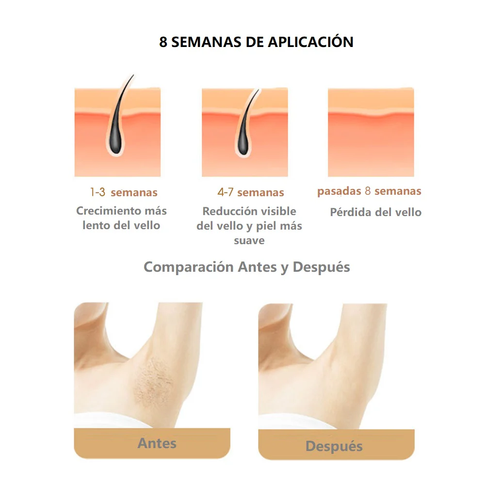 DEPILADORA SOFTSKIN® TECNOLOGÍA IPL + ENVÍO GRATIS - Image 5