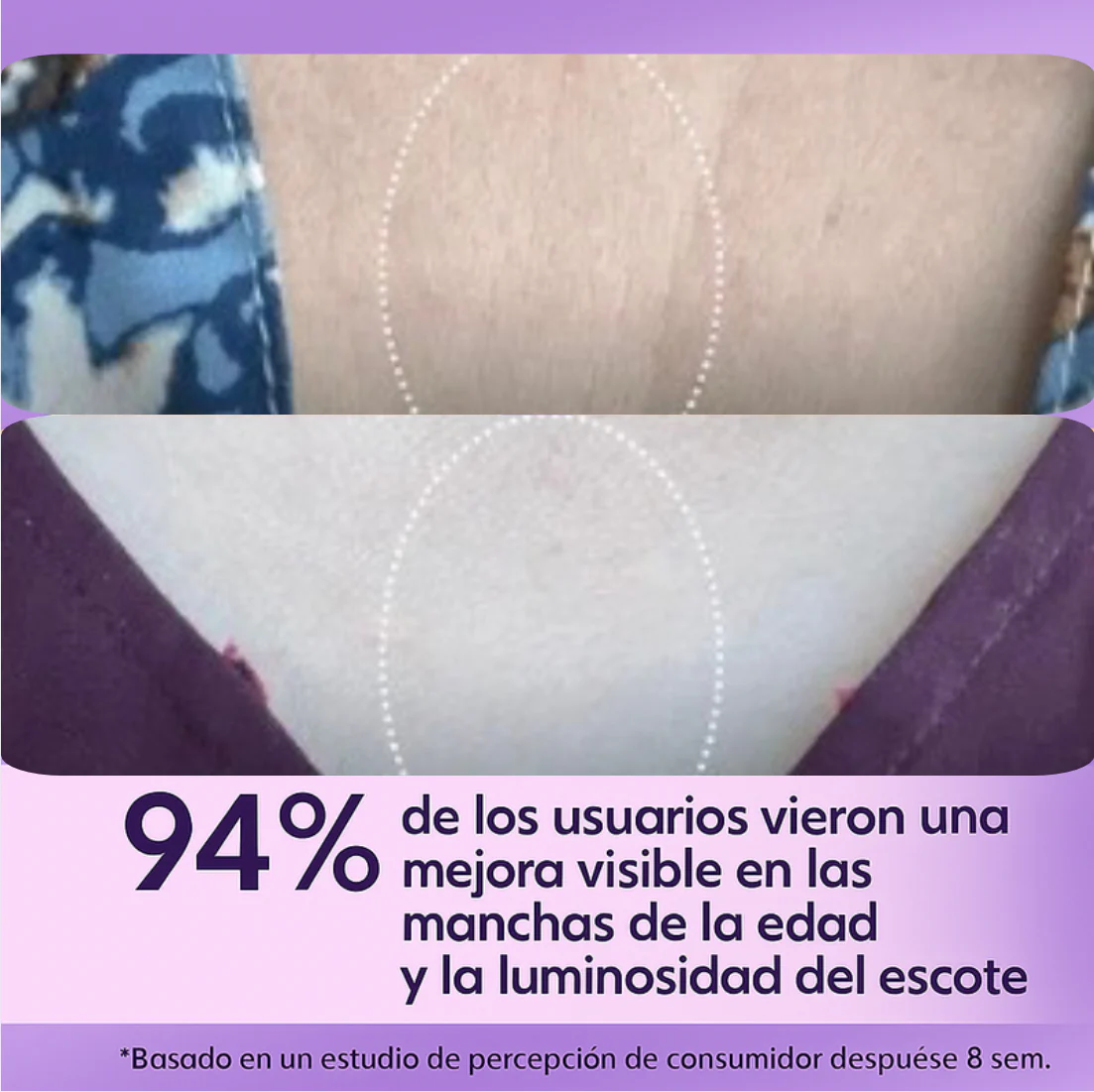 La crema tensora para cuello #1 en el mercado: ¡Siéntete segura! - Image 7