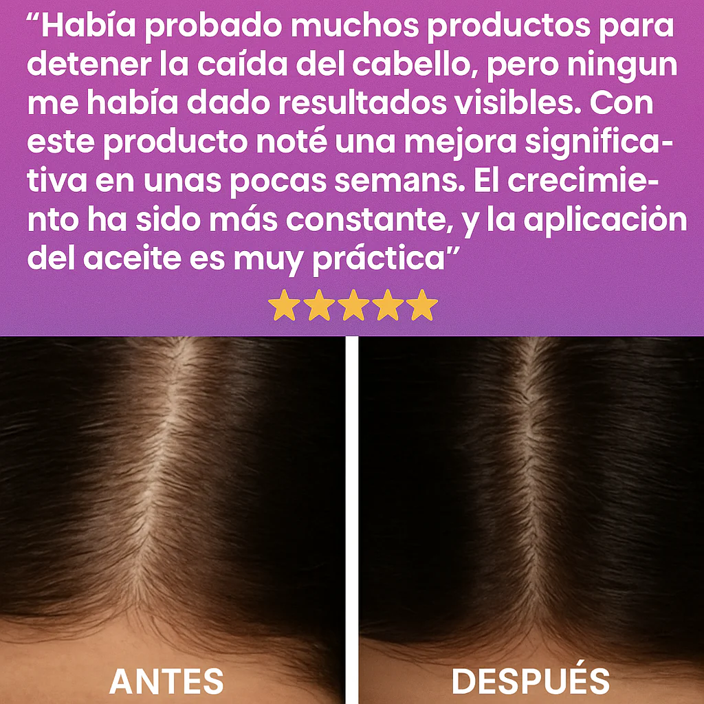 Terapia de Cuero Cabelludo con Luz Roja - Image 3